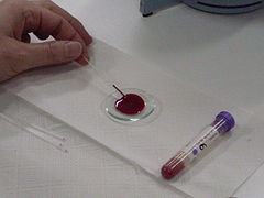 analítica de sangre