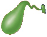 Litiasis vesicular